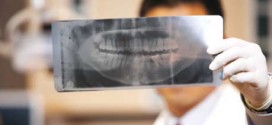 بایدها و نبایدهای رادیوگرافی دندان